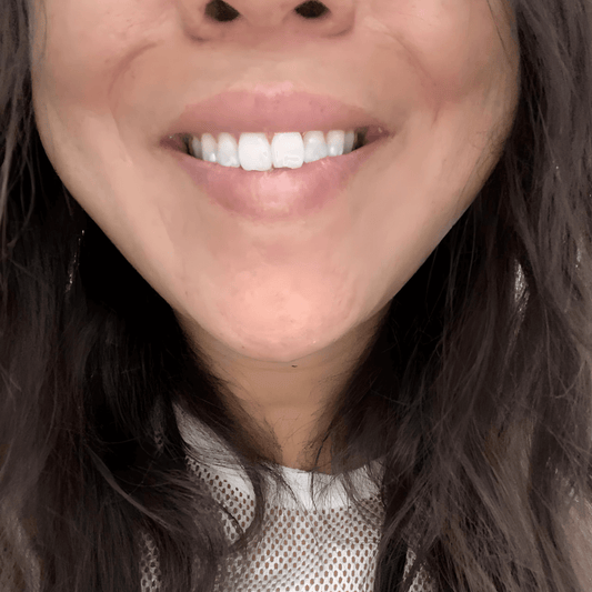 10 טיפים לשמירה על שיניים לבנות אחרי הלבנה